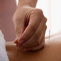 Kate Winstanley Acupuncture London   Harley St Clinic 727101 Image 7